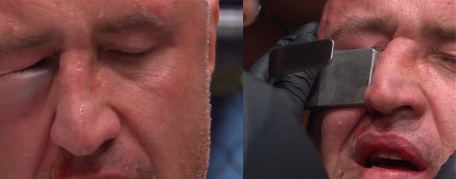 Minda nie dopuszczony do dalszej walki przez kontuzję oka! [ZDJĘCIA]